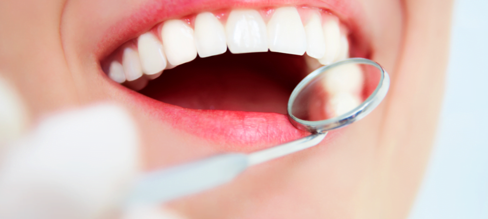Cấy ghép Implant có thể tồn tại suốt đời được không?
