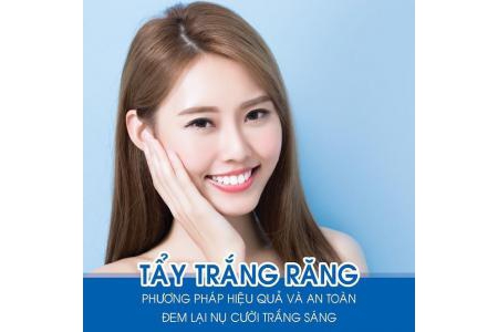 Tẩy trắng răng tại nhà