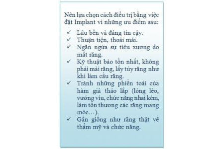 Kiến thức phổ thông về Implant