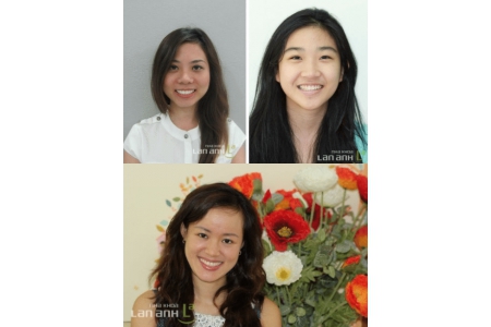 Nhổ răng hạn chế chấn thương trong chỉnh nha
