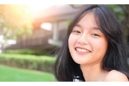 Những điều cần biết trước khi điều trị chỉnh nha – niềng răng
