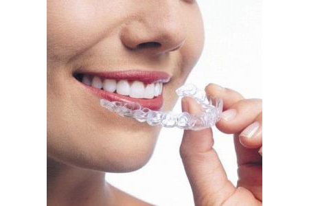 Niềng răng không mắc cài invisalign – Hình ảnh ca thực tế