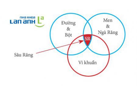 Những lệch lạc thường thấy nơi răng trẻ em và chỉnh nha phòng ngừa