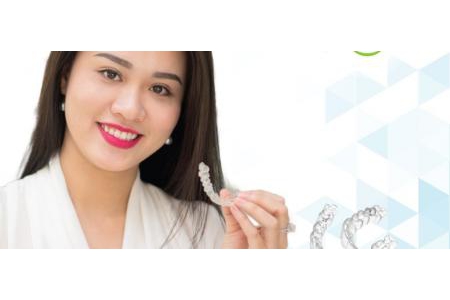 Niềng răng bằng khay Invisalign