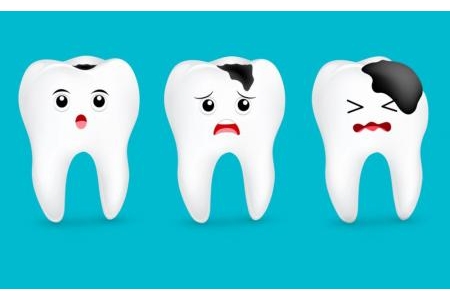 Sâu răng, cách phòng ngừa và điều trị sâu răng