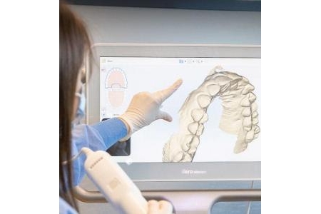 Mô phỏng kết quả niềng răng Invisalign hoạt động như thế nào?