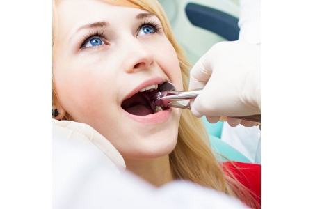 Điều gì là quan trọng nhất khi nhổ răng?