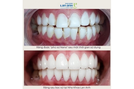 Bạn đã nghe về 