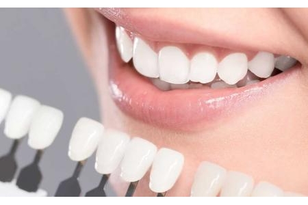Vì sao tẩy trắng răng tại nha khoa lại hiệu quả hơn tự tẩy tại nhà?