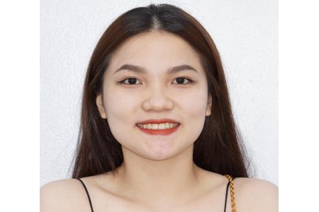 Niềng răng đẹp là như thế nào?