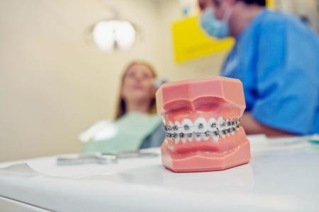 Niềng răng ngày nay có thường phải nhổ răng không?