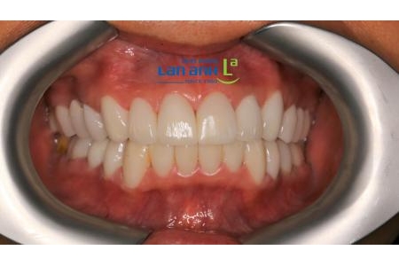 Nụ cười đẹp cần phù hợp với phong cách của riêng bạn