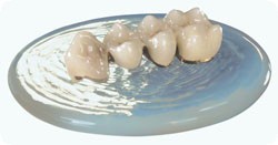 Cầu răng vĩnh viễn-răng giả Cau rang vinh vien-rang gia