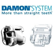 damon system clear - Nha khoa Lan Anh damon system clear - Nha khoa Lan Anh