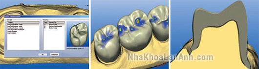 phân tích trước khi làm răng sứ phan tich truoc khi lam rang su