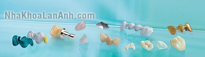 mẫu răng sứ sau khi hoàn tất mau rang su sau khi hoan tat