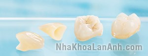 răng sứ hoàn tất_cerec_inlab rang su hoan tat_cerec_inlab