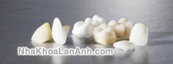 mão vĩnh viễn-răng giả mao vinh vien-rang gia