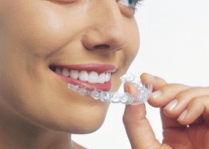 khay invisalign se duoc bac si huong dan ban mang dung cach