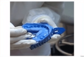 khay lay dau chuyen biet danh rieng cho invisalign 