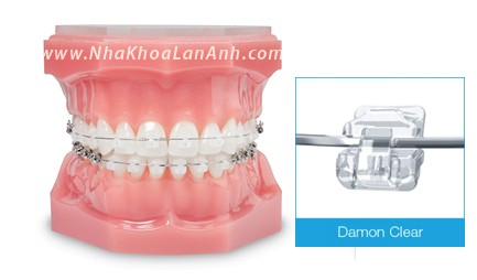 Mac cai Damon Clear