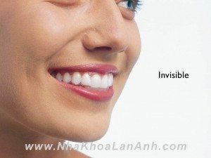 Dung khay Invisalign