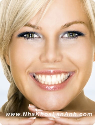 hinh: nu cuoi “dep” theo quan diem ngay nay., nha khoa tốt ở tphcm
