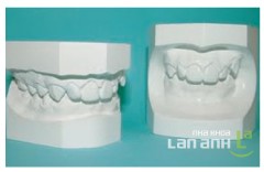 Mẫu hàm bằng thạch cao Mau ham bang thach cao