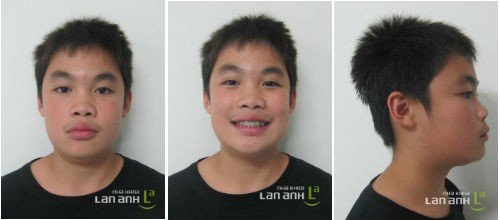Benh nhan nam chinh nha