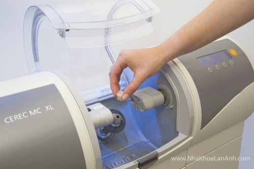 CEREC_MC_XL_Foto_2-1(1)