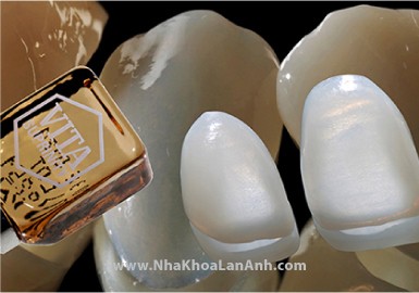 Hình: Thỏi sứ EmaxCAD của Ivoclar Vivadent và Veneer mỏng được tiện nguyên khối từ máy MCXL.