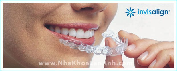 Khi thao khay Invisalign