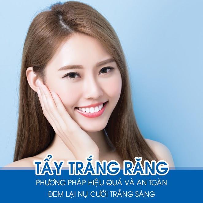 tay trang rang tai nha giup ban so huu nu cuoi tuoi tan