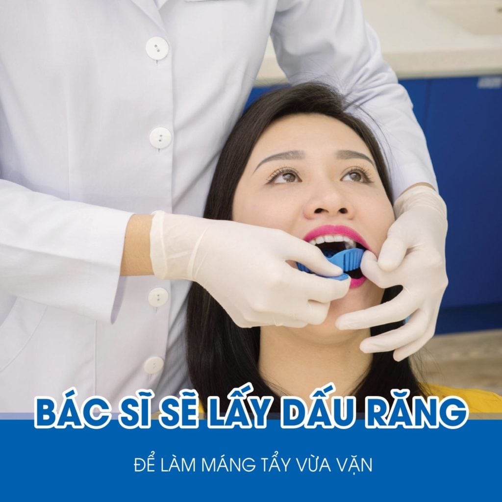 qua trinh lay dau rang lam mang tay khi tay trang rang